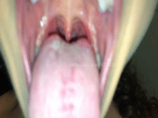 Annie arbor mouth pics