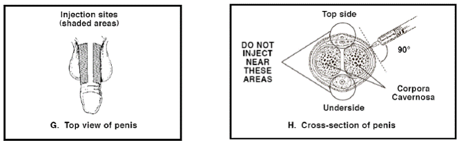 Relay reccomend three injections consecutively into testicle