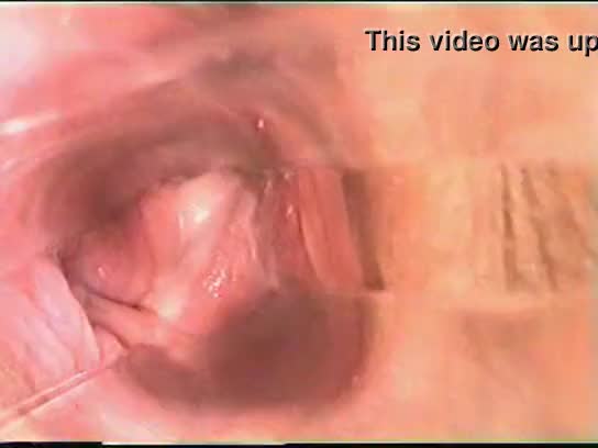 best of Sexe inside vagina speculum bizarre camera