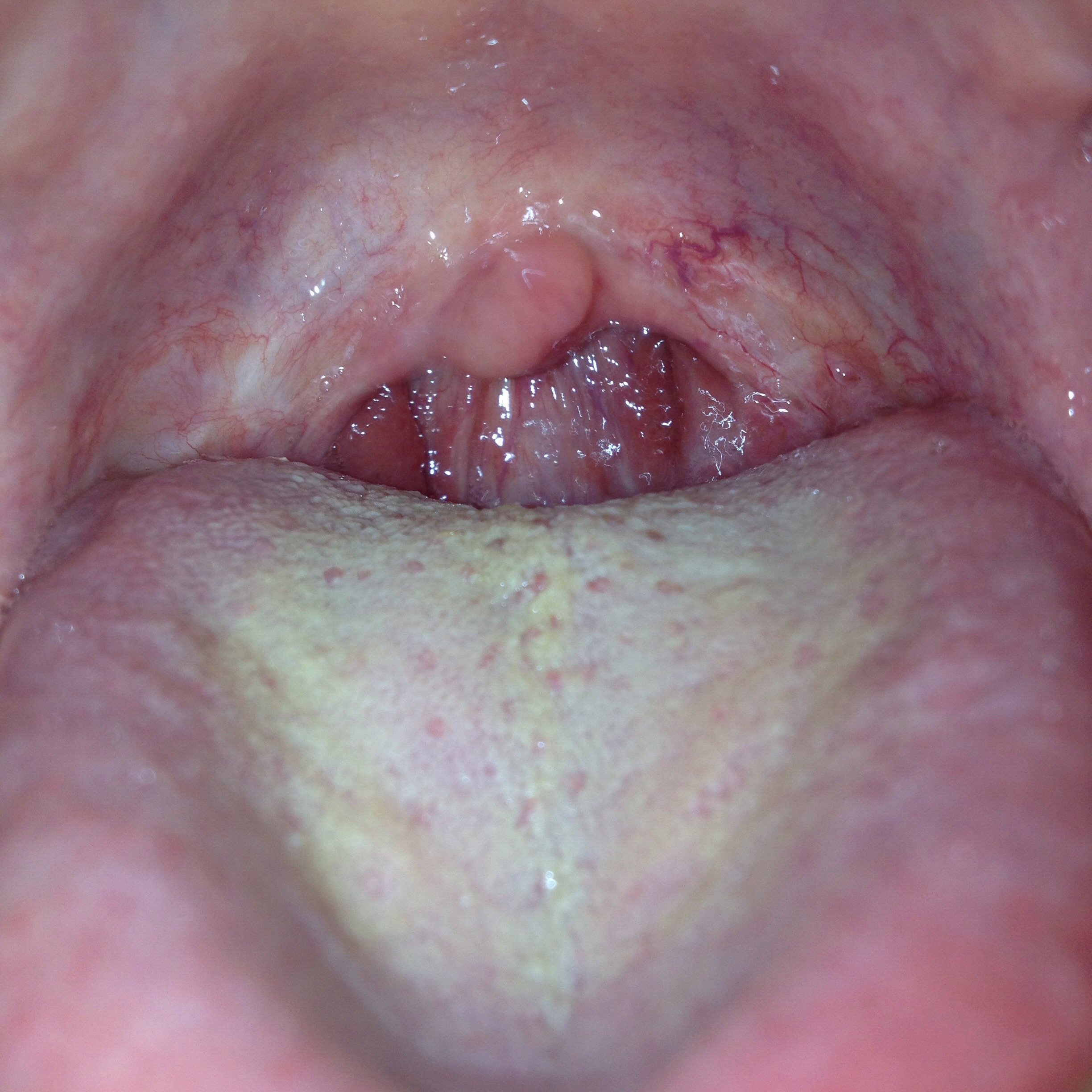 Slobber-knocker recommendet best uvula ever