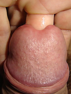 Fetish extraction with urethral dilatation anal